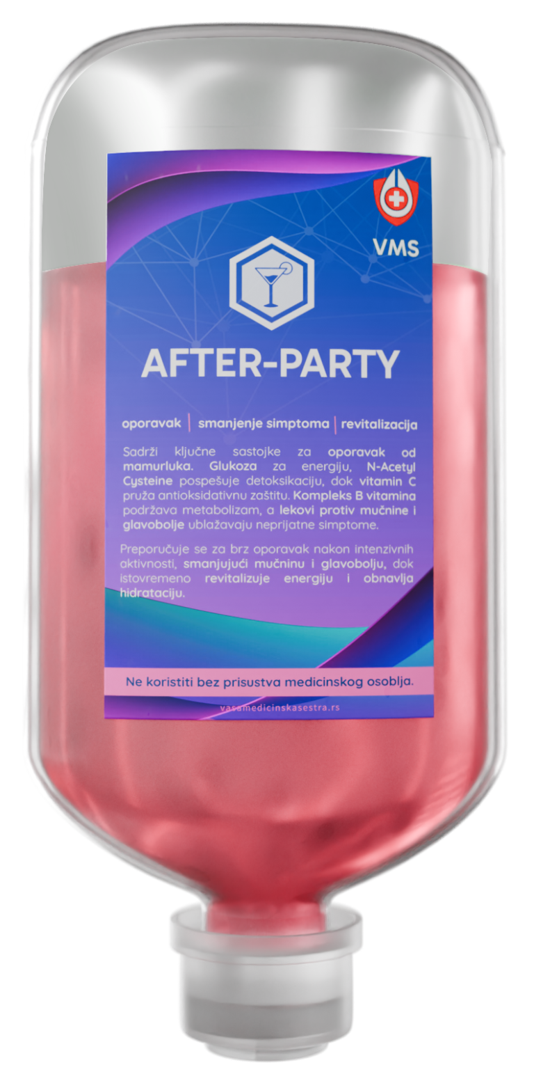 After-Party